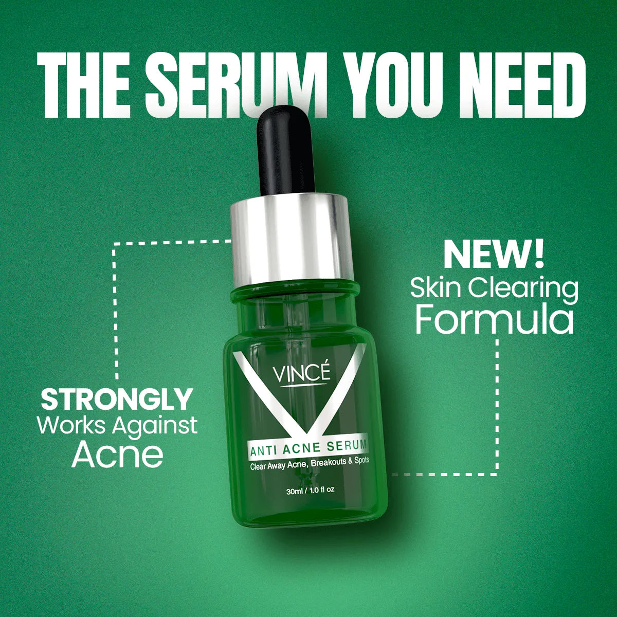 Vince Anti Acne Serum - 30ml