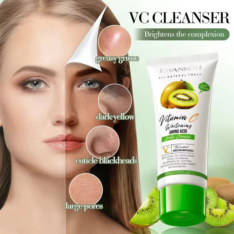 FAYANKOU Kiwifruit Extract Whitening Oil Control Cleanser – 100g