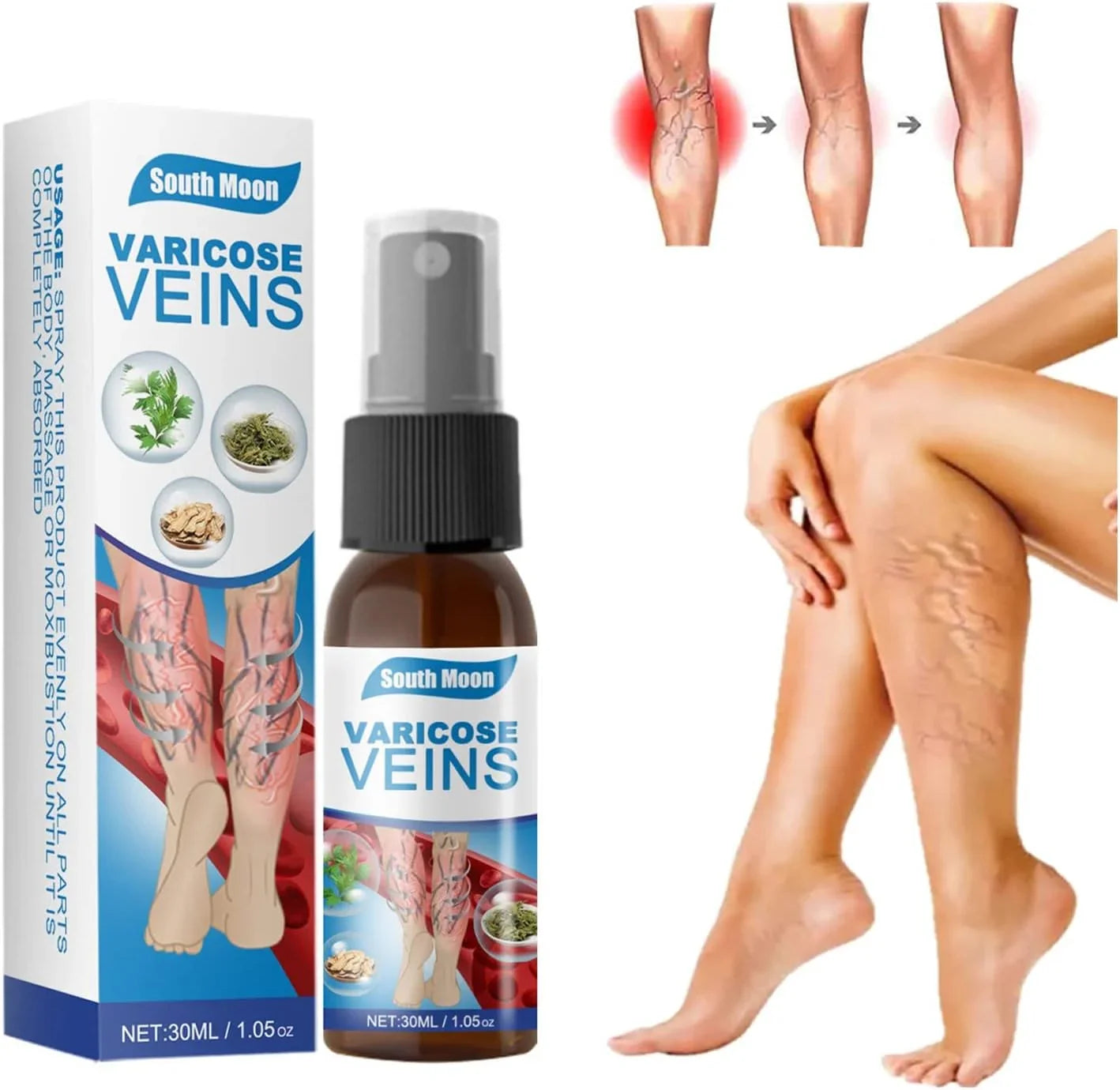 South Moon Vein Healing Varicose Veins Treatment Spray - 30ml