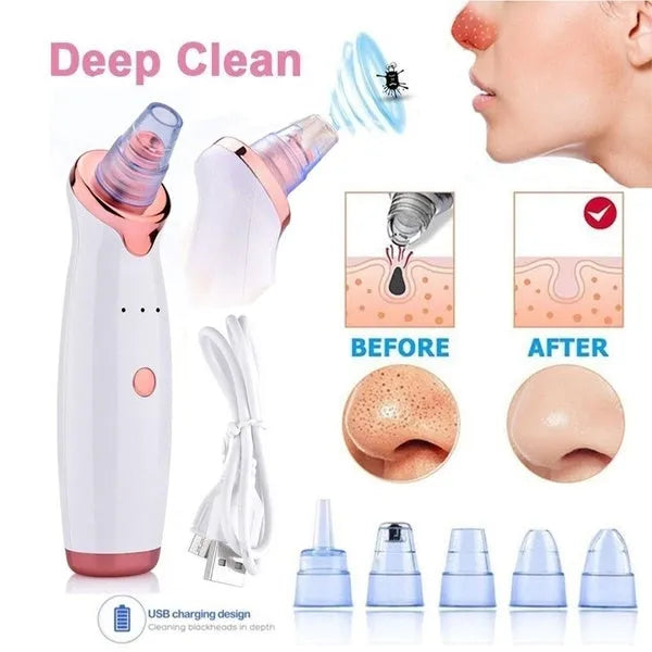 5-in-1 Multi-functional Blackhead Removal Device