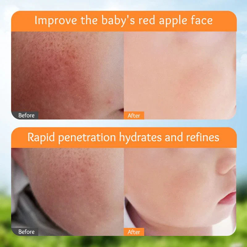 Sadoer Calendula Amino Acid Formula Baby Moist Cream – 50 g